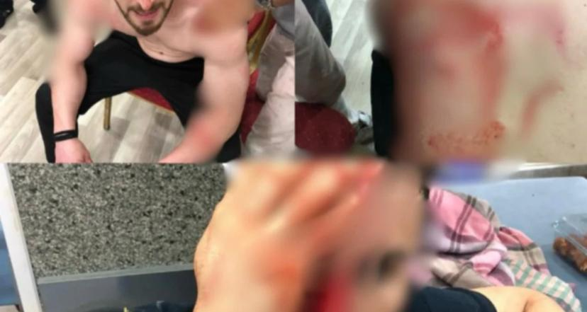 İşçilere Karşı Sıradanlaşan Şiddet !